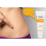 کرم رفع ترکهای پوستی گاتیو (استرچ مارک) ۱۰۰mL