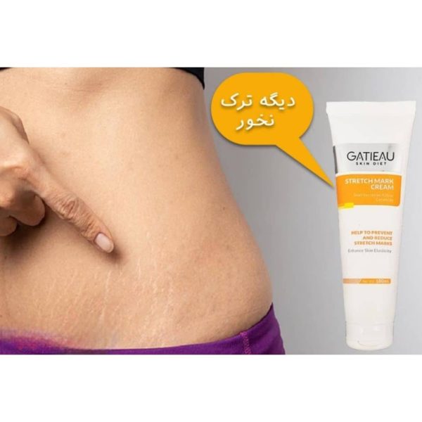 کرم رفع ترکهای پوستی گاتیو (استرچ مارک) ۱۰۰mL
